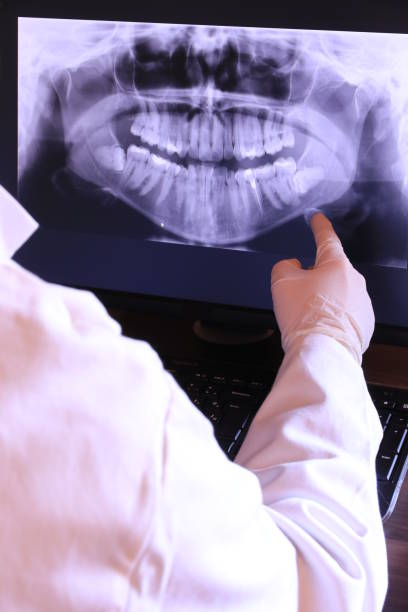 Best Emergency Treatment for Oral Infections in East Basin, UT